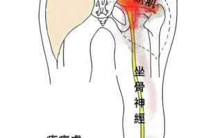 孕期屁股酸痛是胎儿压迫还是缺钙？这些原因别忽视！