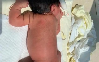 新生儿一个月黄疸还没退，是正常现象还是需要就医检查？