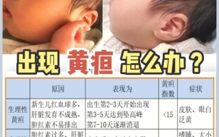 新生儿黄疸170μmol/L算严重吗？需要照蓝光治疗吗？
