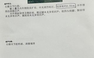 儿童髋关节滑膜炎的病因、症状与治疗方案有哪些关键点？