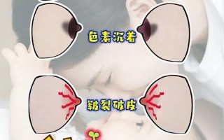 新生儿乳腺炎症状图片有哪些？如何通过图片辨别与护理？