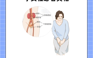 备孕期尿路感染怎么办