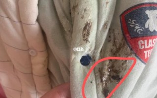 新生儿吐咖啡色呕吐物是消化道出血吗？该怎么办？