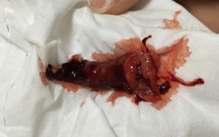 怀孕时梦见流产，是身体预警还是心理压力的投射？