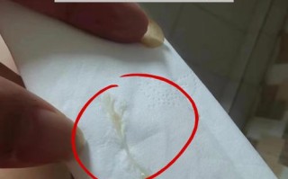 孕期白带增多是正常生理现象吗？需不需要特别关注或处理？