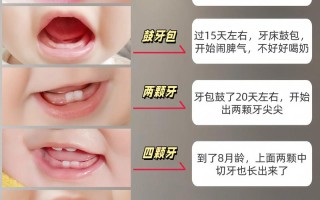 新生儿出牙前牙床图片是什么样子？正常状态和异常表现如何区分？