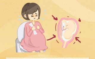 孕期痔疮究竟是如何悄悄找上门来的？