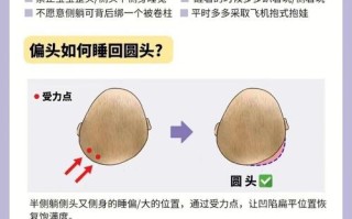 新生儿头型由睡姿决定吗？