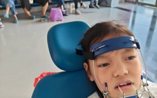 儿童地包天矫正器图片