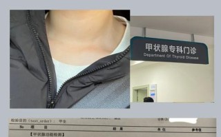 孕期四碘甲状腺素偏高会对胎儿发育有什么影响？