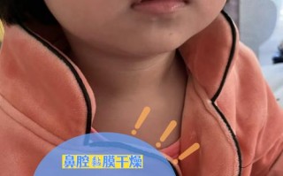 5岁孩子总流鼻血是上火还是生病？家长该怎么处理才正确？