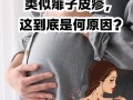 孕期背上长湿疹又痛又痒，到底能不能用药？会对宝宝有影响吗？