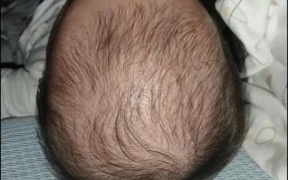 新生儿睡觉头总歪一边是正常现象吗？需要干预吗？