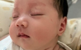 新生儿脖子肉多双下巴是正常现象吗？需要干预吗？