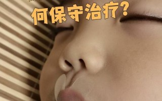 儿童鼻子腺体肥大图片