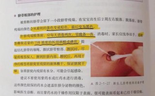 新生儿肚脐眼消毒到底该怎么做才正确？