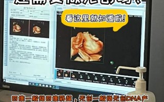 怀孕期间没做四维彩超