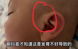 新生儿耳仓会藏污纳垢吗？日常护理要注意哪些细节才能避免感染？