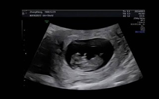 孕期B超报告单上的字母代码究竟是什么含义？新手爸妈该如何快速读懂这些数据？