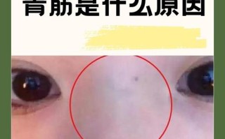 新生儿人中发青是缺氧还是血液循环异常？需警惕哪些潜在健康问题？