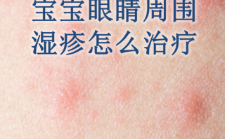 儿童过敏该选哪家医院？专业科室、专家团队与治疗经验如何权衡？