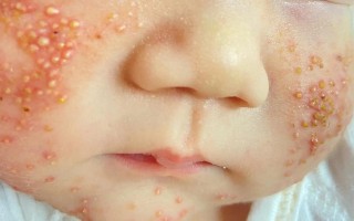 新生儿酰基肉碱是什么？为何检测其水平对宝宝健康如此重要？