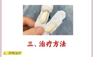 备孕期间查出霉菌感染，不用药怕影响怀孕，用药又怕伤胎儿，到底该怎么办？