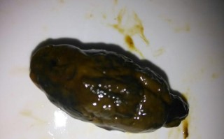 新生儿大便出现黑色颗粒是正常现象还是需要警惕的健康信号？