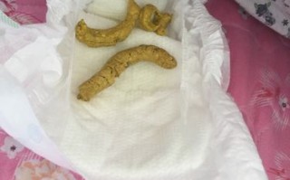满月新生儿拉条状大便正常吗？需警惕哪些健康问题？