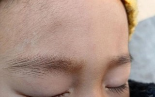 新生儿误食大量绒毛会有危险吗？如何处理和预防？