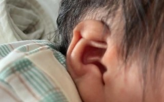 新生儿耳声发射不通过