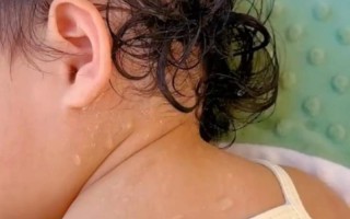 六岁儿童夜间睡觉出汗，是正常现象还是健康预警？