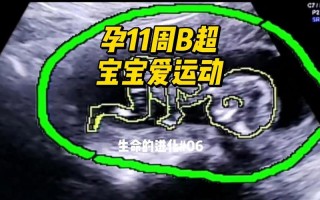 孕期十一周胎儿发育图显示哪些关键变化？此刻宝宝发育到什么程度了？