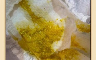 新生儿大便全是奶瓣是消化不良还是正常现象？