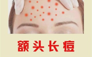 孕期额头长痘是激素变化还是其他原因？