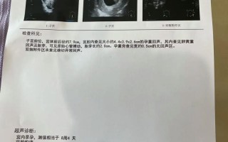 孕期做8次彩超是否必要？频繁检查对胎儿有影响吗？