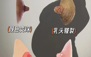 孕期如何保养乳房更大