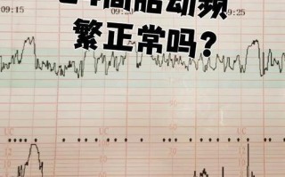 孕期胎动幅度不大，是宝宝发育迟缓还是个体差异？需要警惕哪些异常信号？