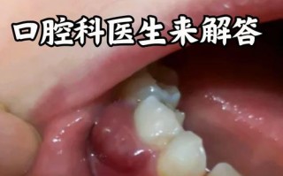 儿童牙龈长白色脓包是啥原因？