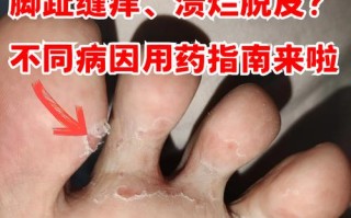 儿童脚趾脱皮是缺乏维生素还是皮肤病？