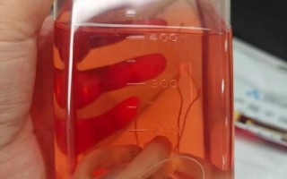 新生儿脐带干细胞存储