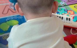 新生儿剃头发型后脑勺头发稀少怎么办？会影响头皮健康吗？