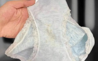 孕期分泌物发黄正常吗？是否需要就医检查呢？