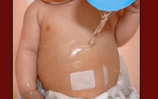 新生儿肚脐多久能完全长好？护理不当会感染吗？