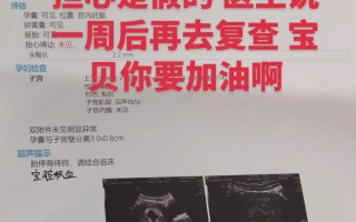 孕期多久能检测到胎心胎芽？早孕期B超检查时间有讲究吗？
