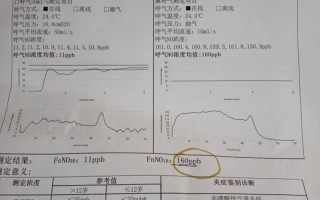 儿童哮喘如何科学检查确诊？这些关键检查项目家长须知！