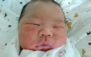 新生儿额头红斑会自行消退吗？需要治疗吗？家长该如何护理？