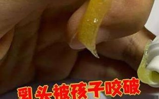 新生儿吃奶把乳头咬破