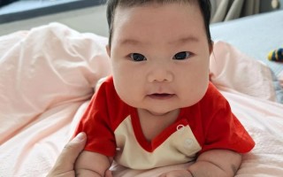 儿童脸上胎记会影响外貌吗？需要治疗吗？家长该如何正确应对？