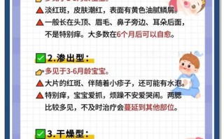 新生儿湿疹反复发作怎么办？日常护理和用药如何科学应对？